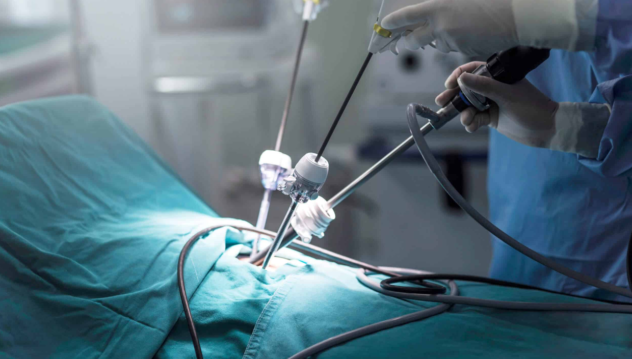 Laparoscopic Surgery